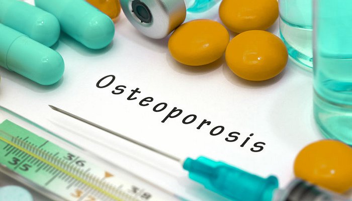 osteoporosis